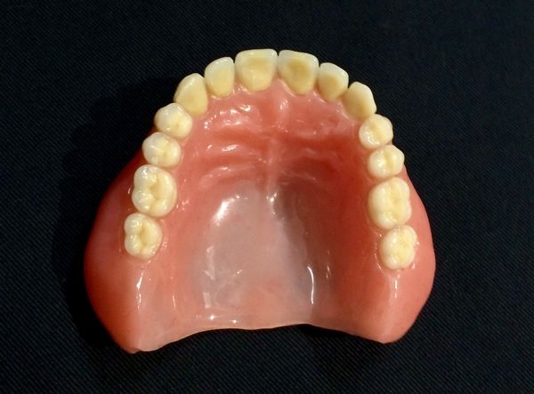 上下顎同時印象法総義歯