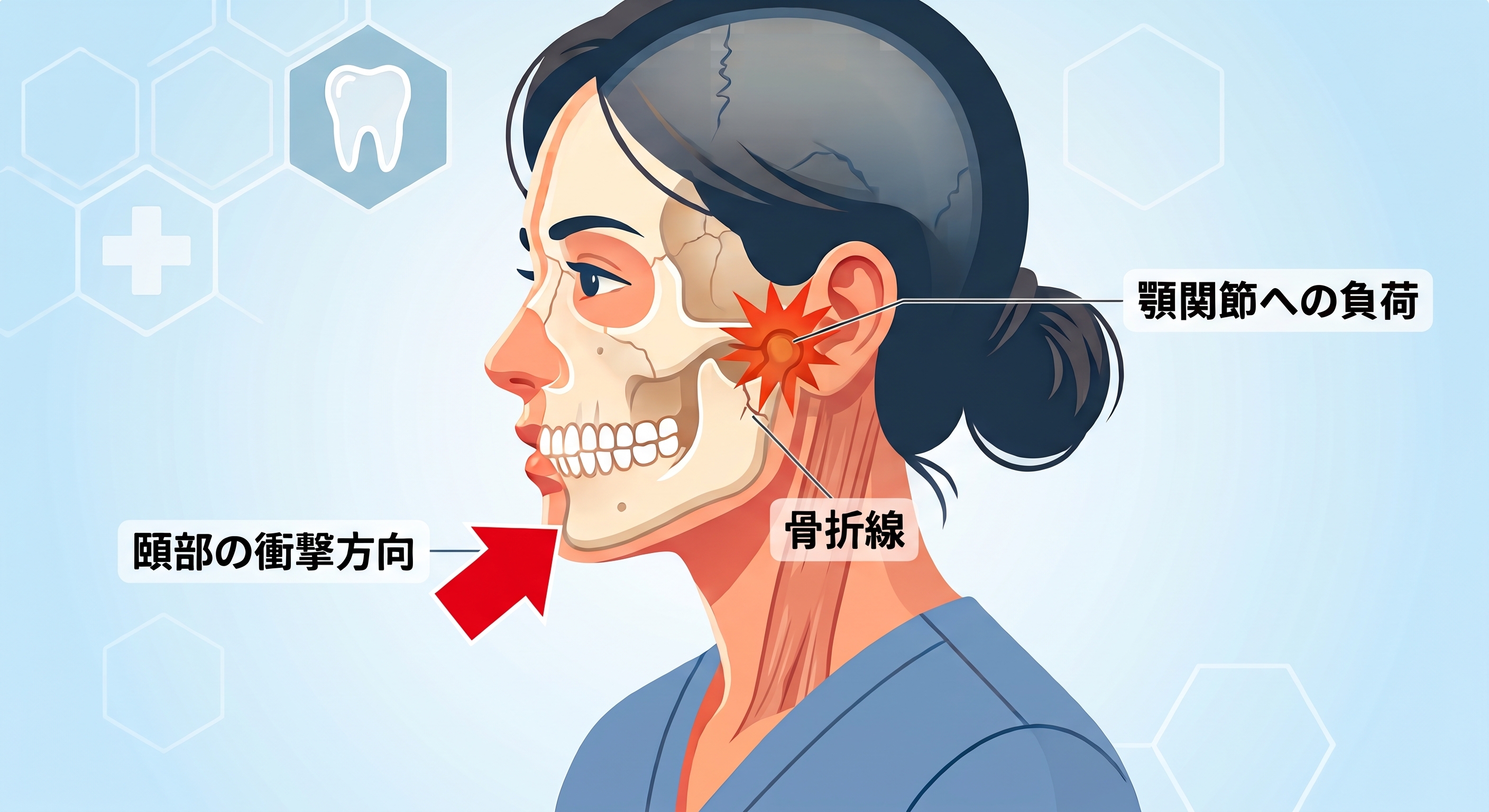 関節突起骨折