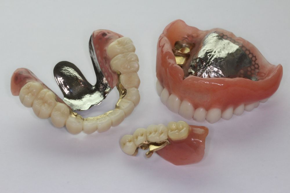 ドイツ式テレスコープ義歯