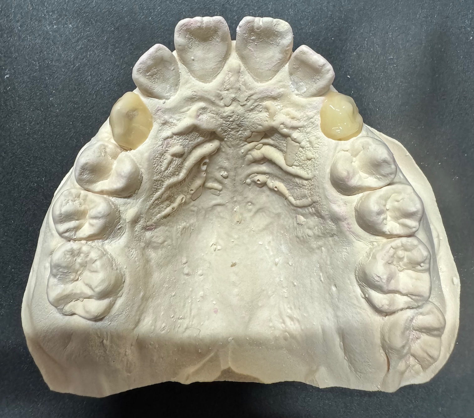 石膏模型リリーフ