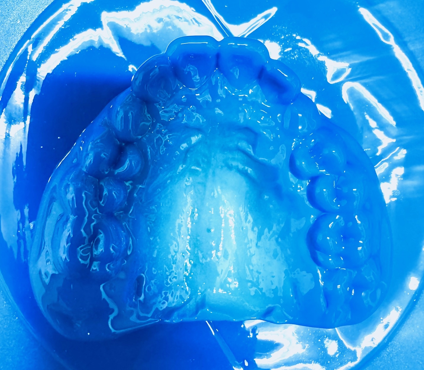 スポーツマウスガード