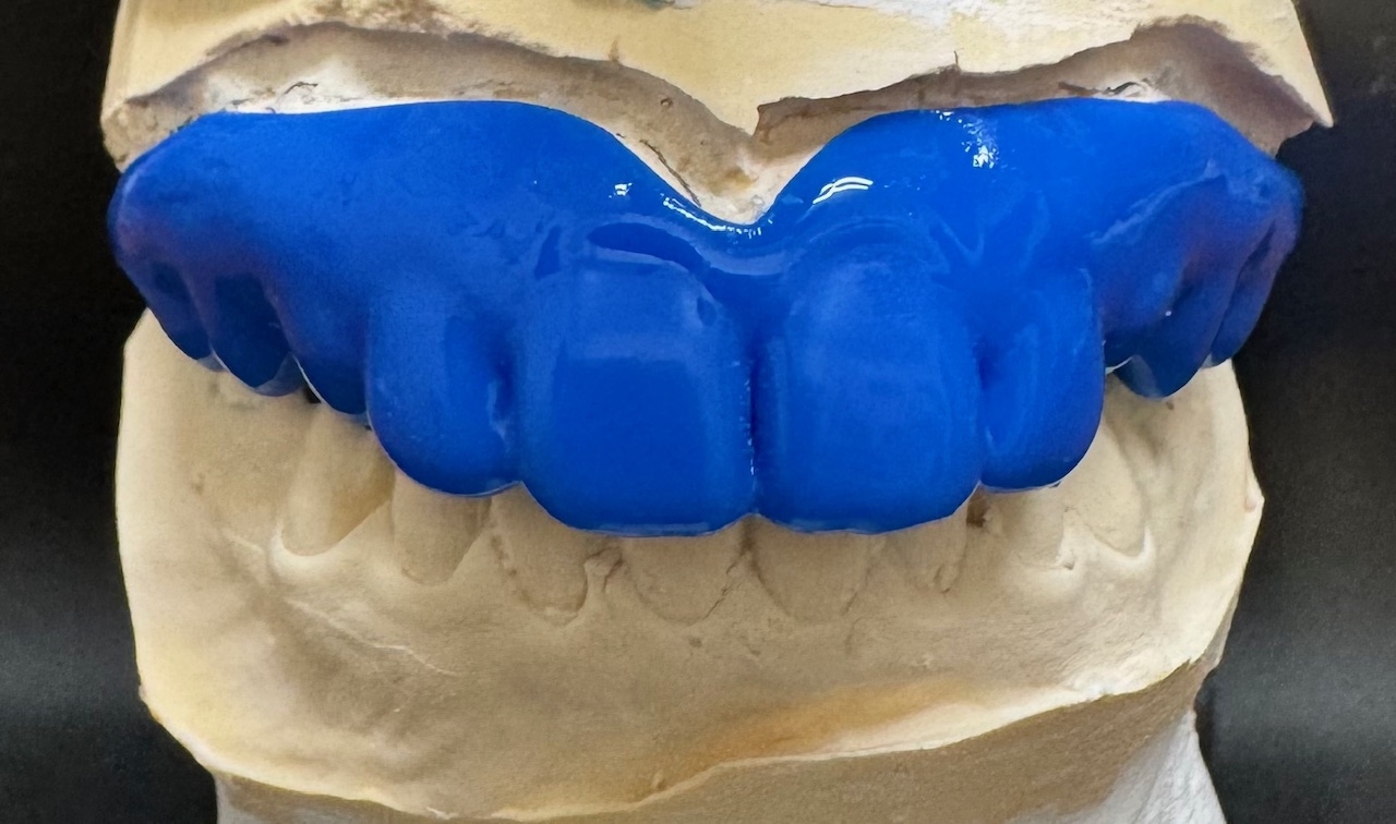 スポーツマウスピース