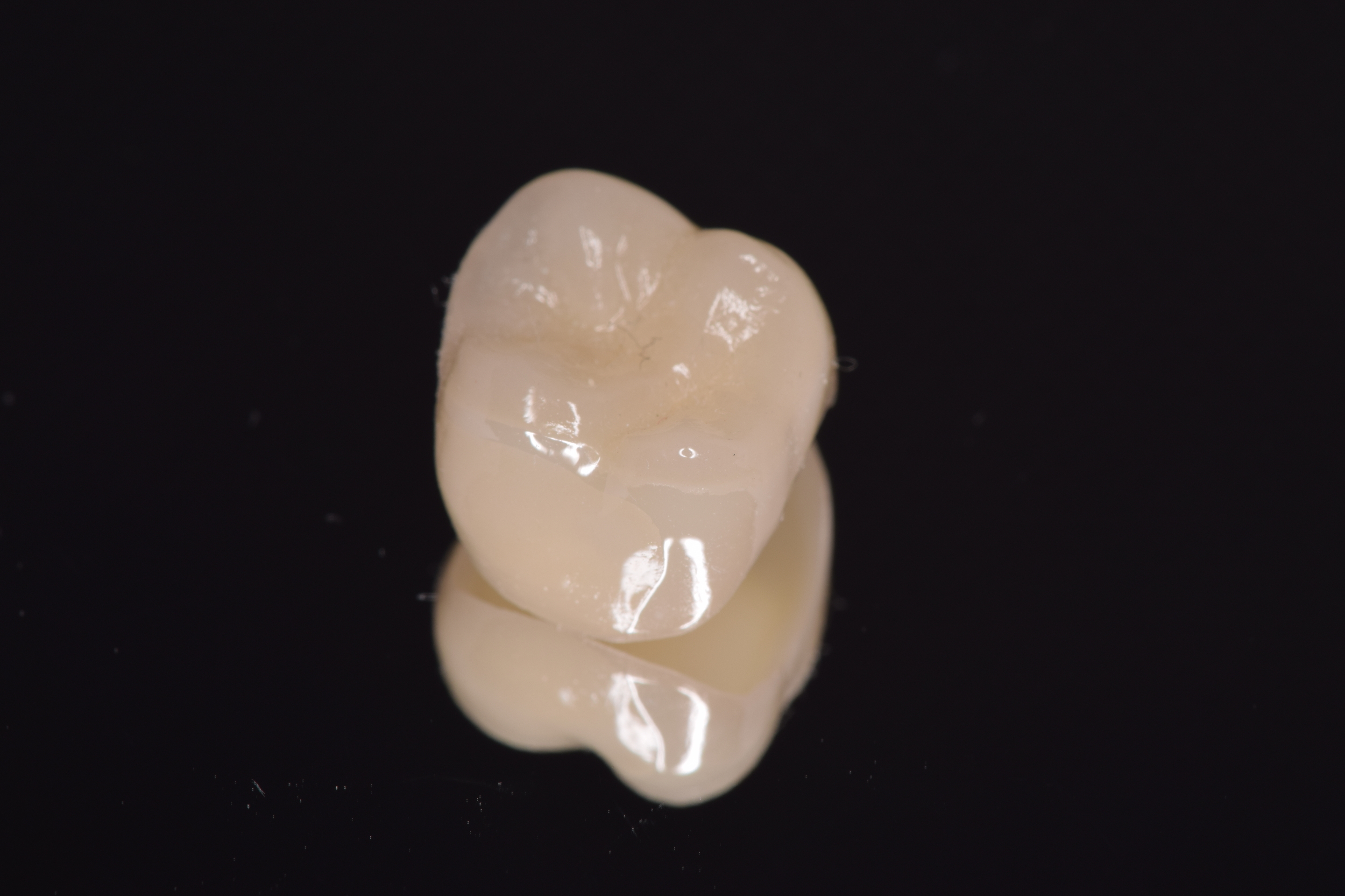 CAD/CAM冠　上顎第一大臼歯