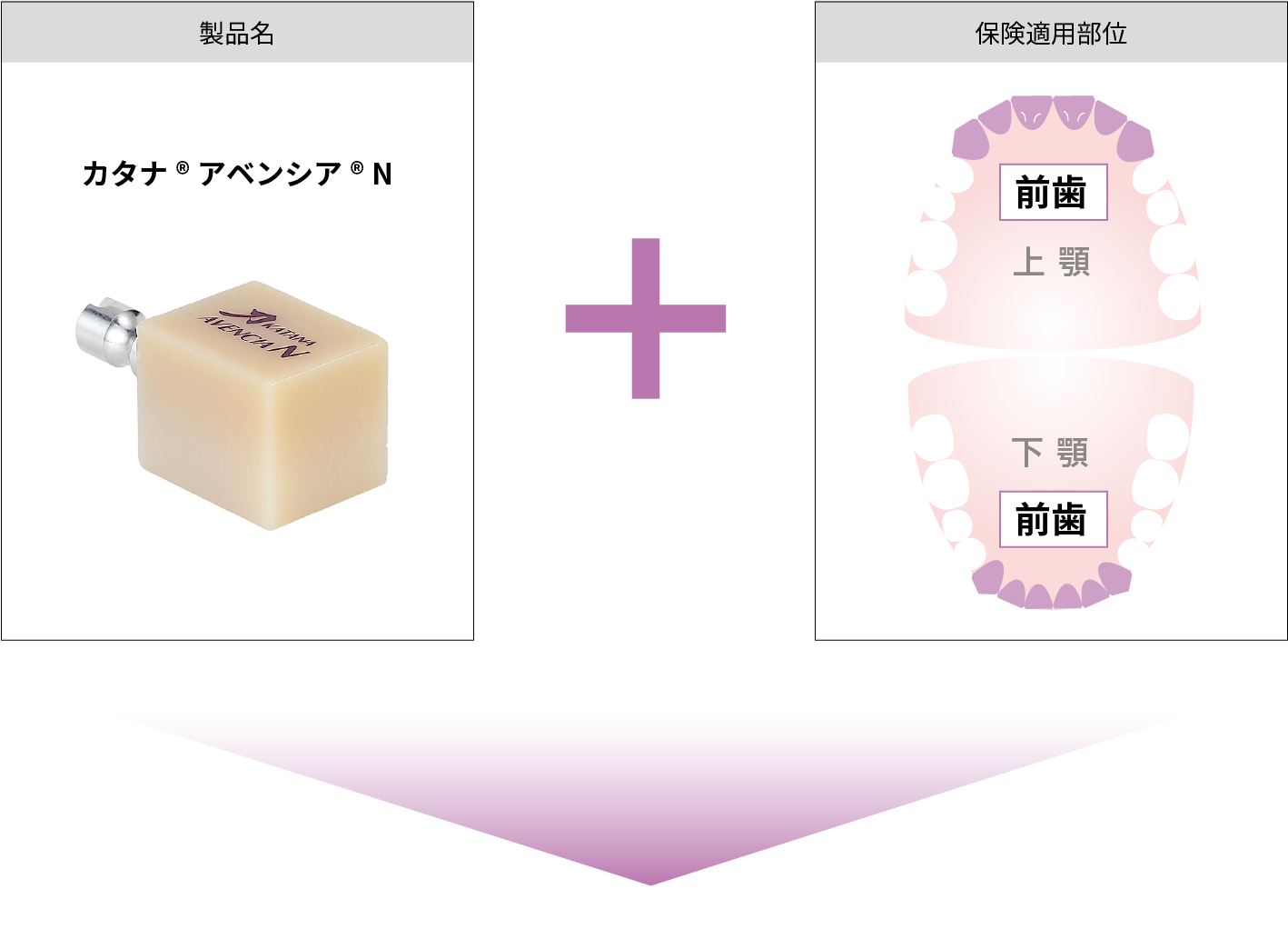 前歯CAD/CAM冠