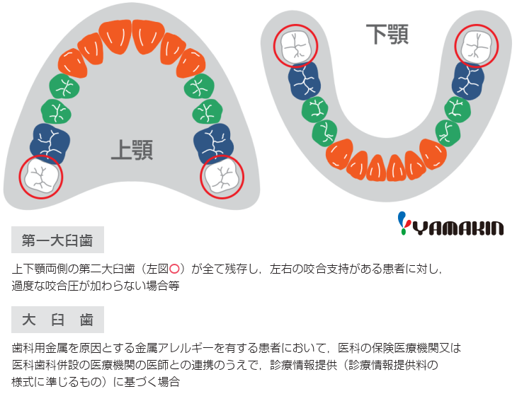 CAD/CAM冠適用範囲